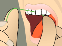 Tooth flossing step 3